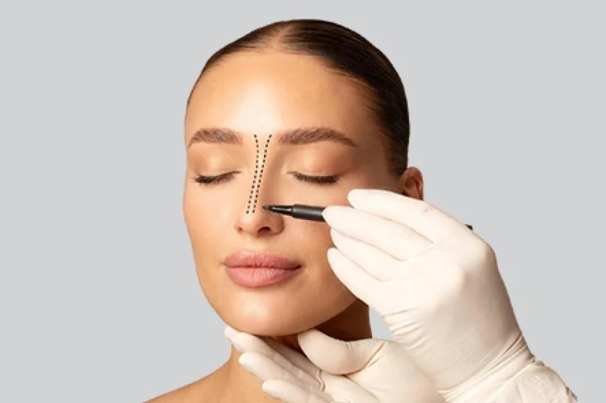 What Is the Procedure of Rhinoplasty Surgery?