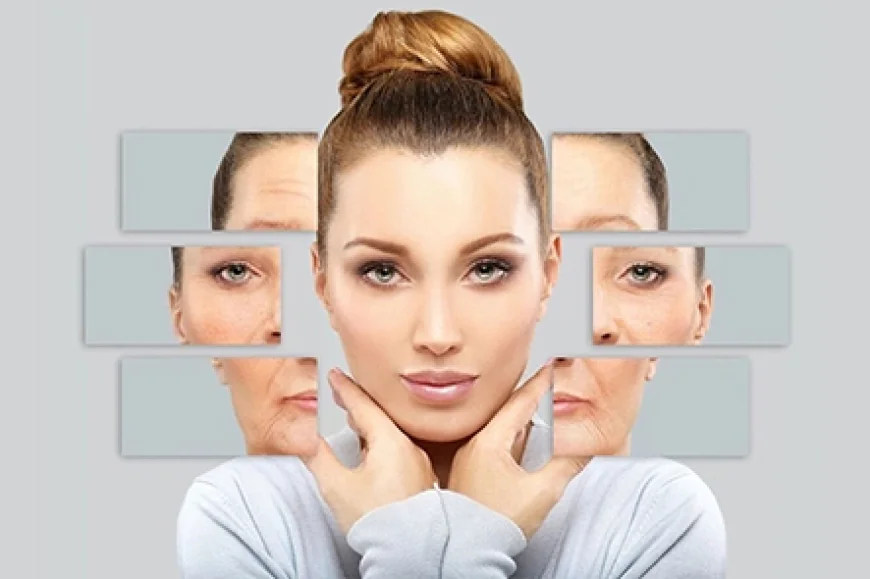 What Is the Procedure of Botox?