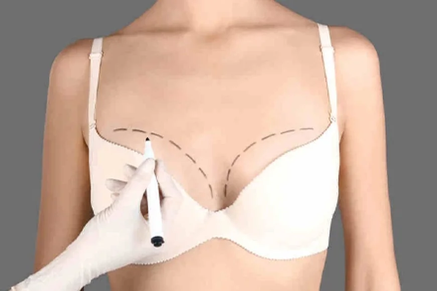 What Is the Procedure of Breast Augmentation Surgery?