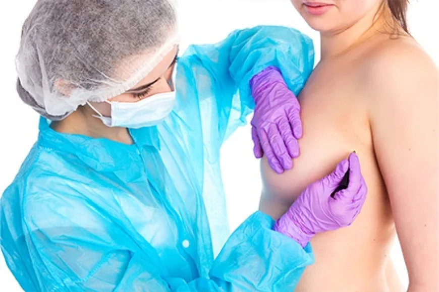 What Is the Procedure for Axillary Breast Removal Surgery?