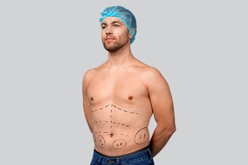What Is the Procedure of 6-Pack Abs Surgery?