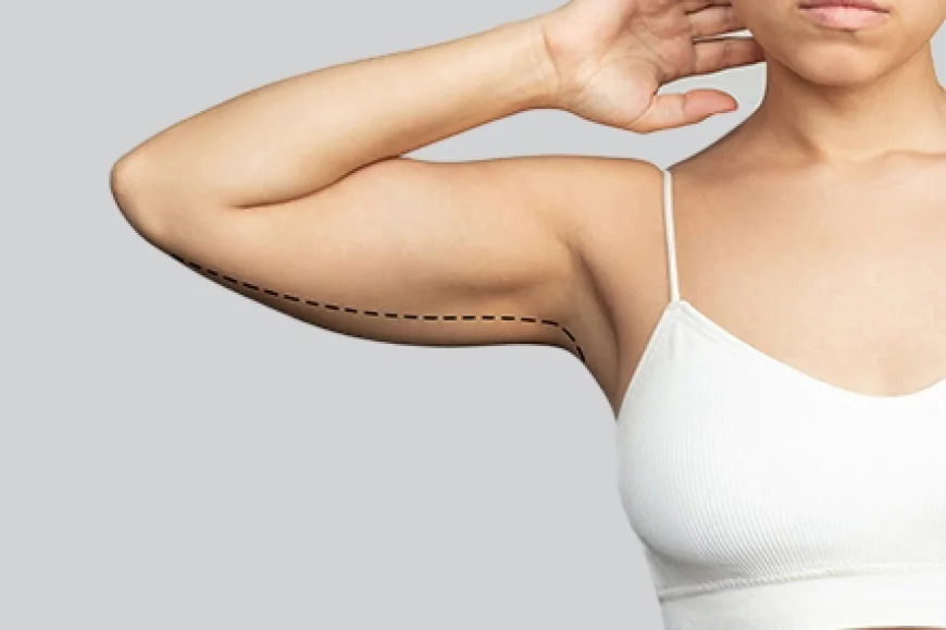 How Is an Arm Lift Surgery Performed?