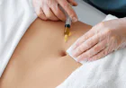 Are Fat Melting Injections Effective for Treating Fat After Weight Loss?