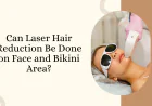 Can Laser Hair Reduction Be Done on Face and Bikini Area?