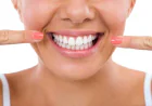 Your Perfect Smile Starts Here: Find the Best Dentist & Tooth Replacement Solutions Near You