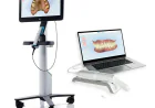 3D Scanner iTero Scan for Faster Dental Solutions