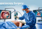 Laparoscopic Surgery in Islamabad for Gallbladder Removal
