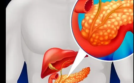 Pancreas Specialist Singapore — Expert Diagnosis & Surgical Excellence