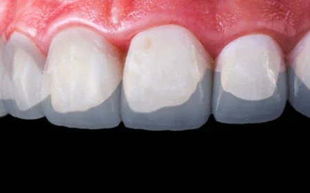 The Ultimate Smile Enhancement Solution You Should Know About