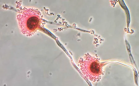 Key Services Available at Enfield STD Clinic in Dubai