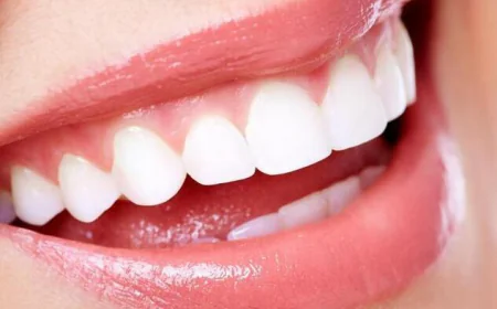 Teeth Whitening in Dubai: Comprehensive Guide to Brighter Smile & Safe Treatments