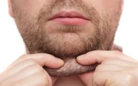 Can a Double Chin Be Removed Without Surgery?