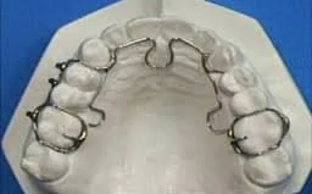 When Is the Right Time to Contact an ALF Provider in LA?