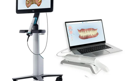 3D Scanner iTero Scan for Faster Dental Solutions