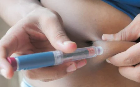 حقن ويجوفي: النتائج طويلة الأمد