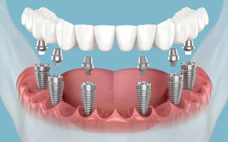 Clear vs. Traditional Braces in Dubai: Which Is Better?