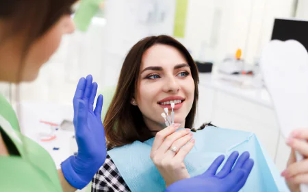 Porcelain Veneers Procedure in Dubai: Step-by-Step Guide