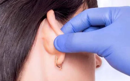 هل عملية تجميل الأذن مؤلمة؟ ما يجب معرفته