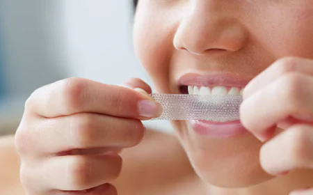 What Are Teeth Whitening Strips and How Do They Work?