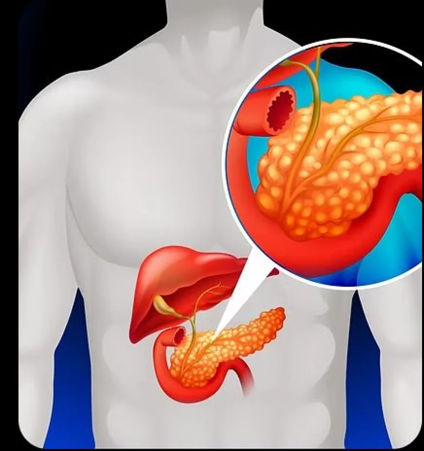 Pancreas Specialist Singapore — Expert Diagnosis & Surgical Excellence