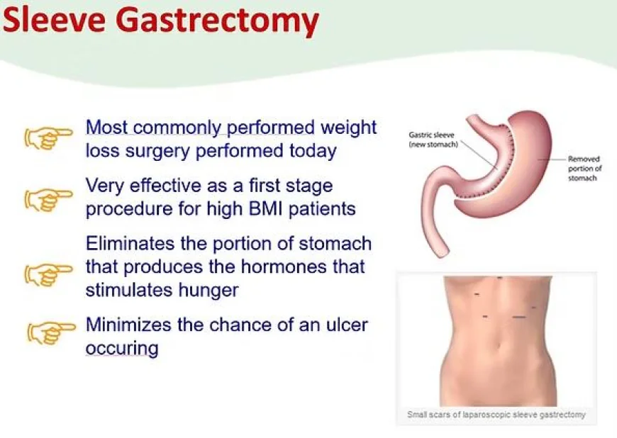 Weight Loss Surgery Singapore: Safe, Advanced & Life-Changing Bariatric Solutions in 2026