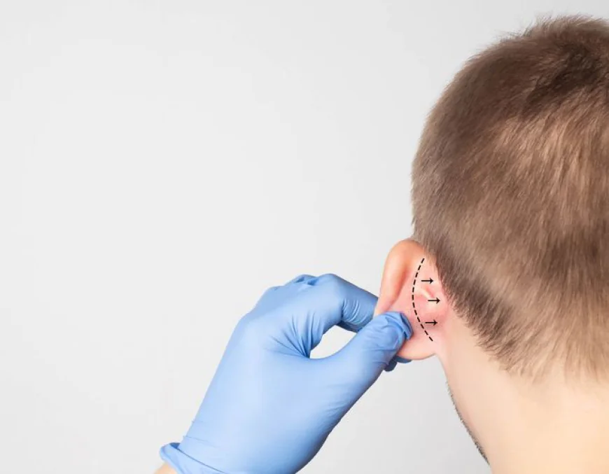 Ear Reshaping Surgery in Islamabad: A Comprehensive Guide