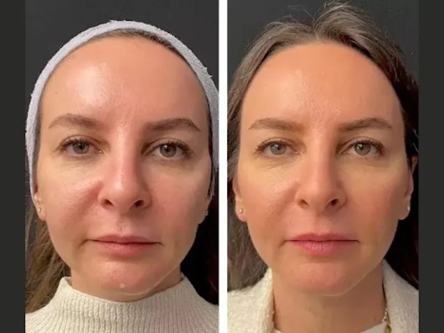 Best Aesthetic Clinic in Dubai for Personalized Skin Care Programs