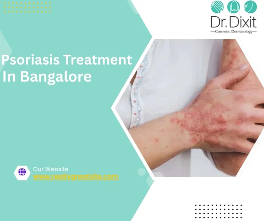 Psoriasis Flare-Ups: What Triggers Them and How to Control Them