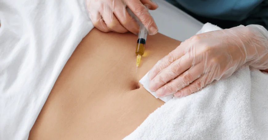 Are Fat Melting Injections Effective for Treating Fat After Weight Loss?