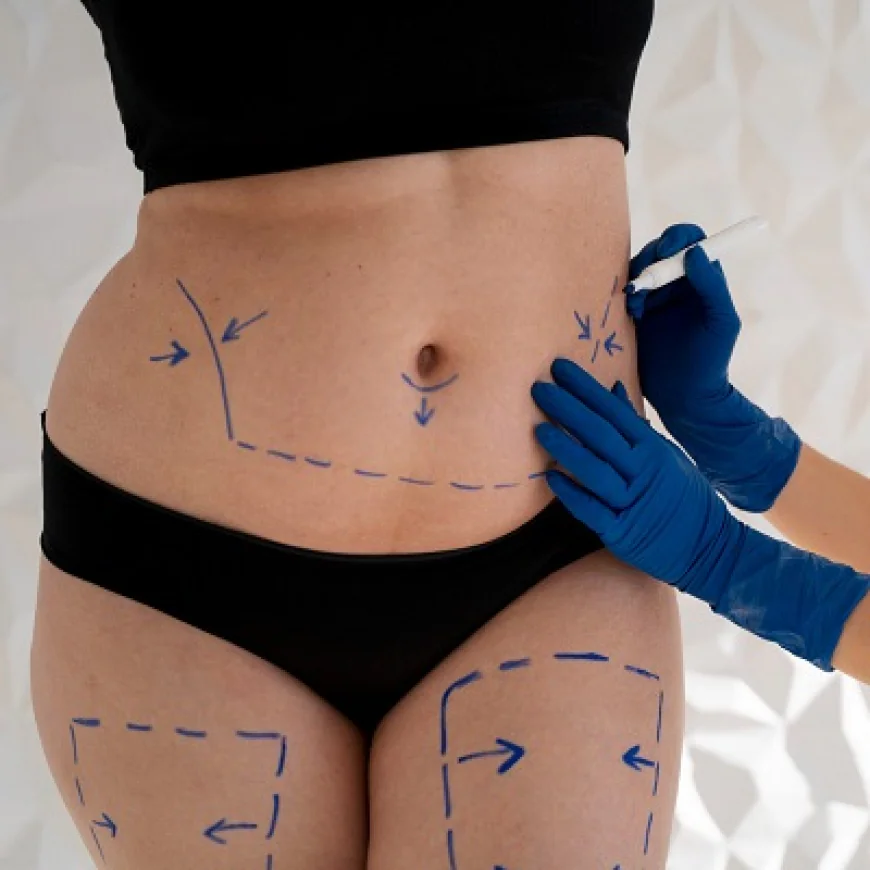 شد البطن بعد الولادة القيصرية: نصائح السلامة