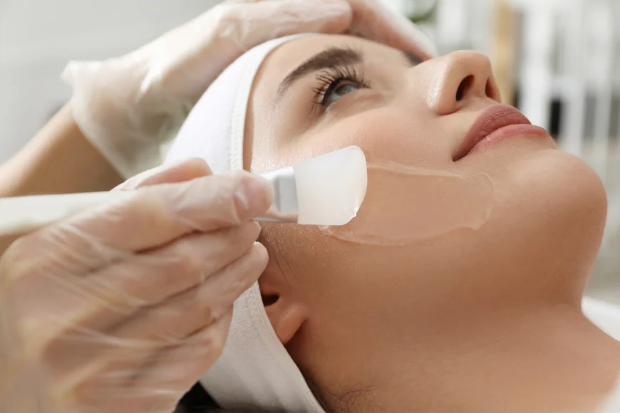 How Many Cold Peel Sessions Are Typically Required?