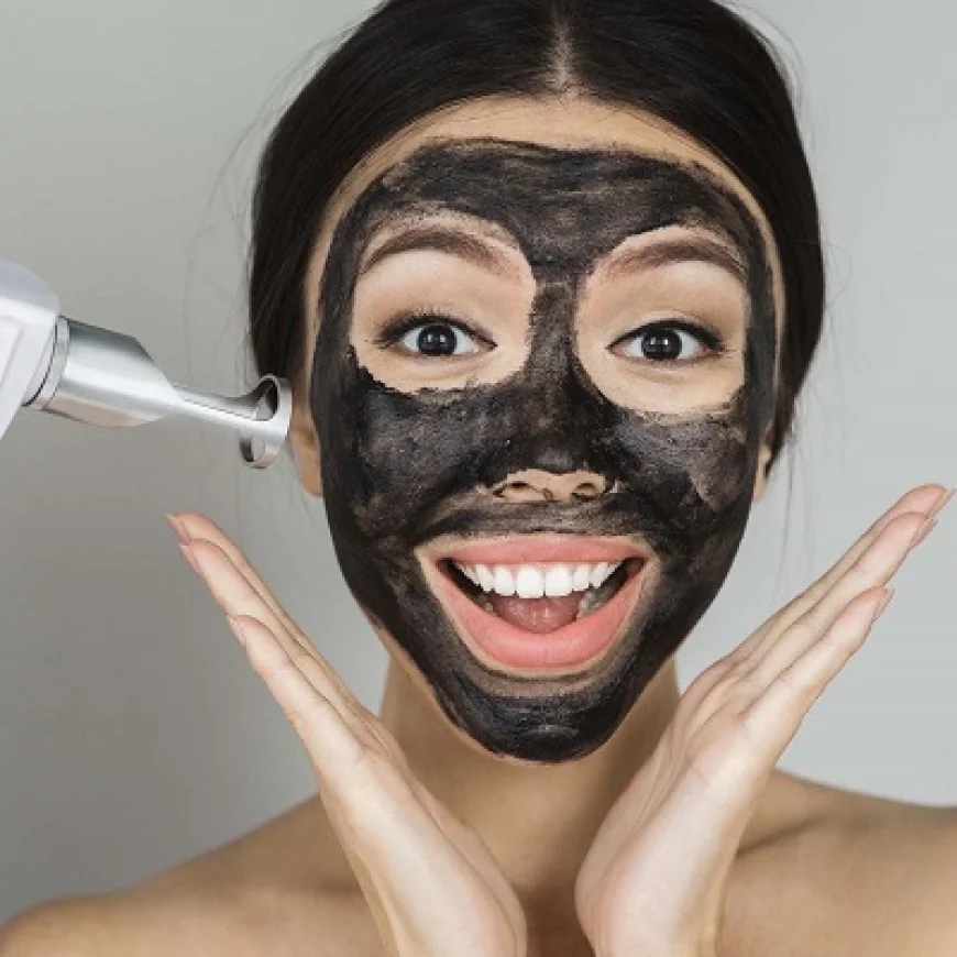 Does Laser Carbon Peel Help Even Out Uneven Skin Tone?