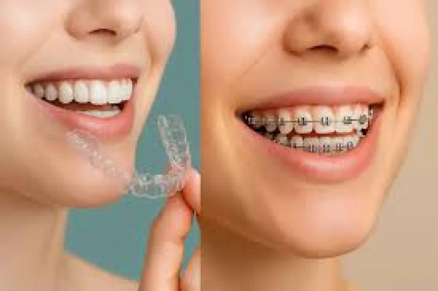Braces and Invisalign: Effective Orthodontic Treatments for a Healthier Smile