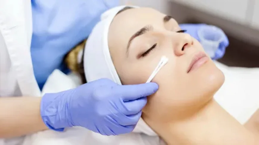 Chemical peel in Dubai: Best Solutions for Acne and Scars