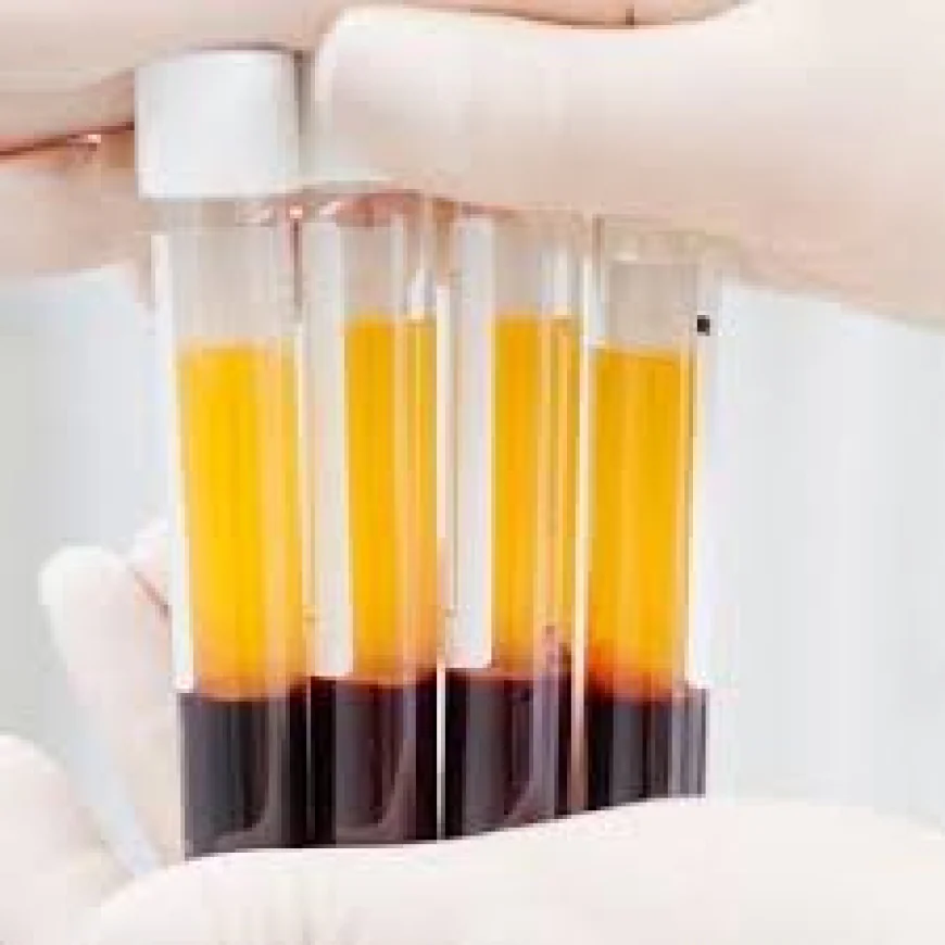 How Does Concentrated Growth Factor (CGF) Therapy Work?