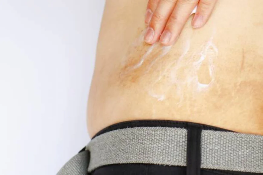 Top Imported Crack Cream | The Best Skincare Product in Pakistan to Heal Cracked Skin Fast