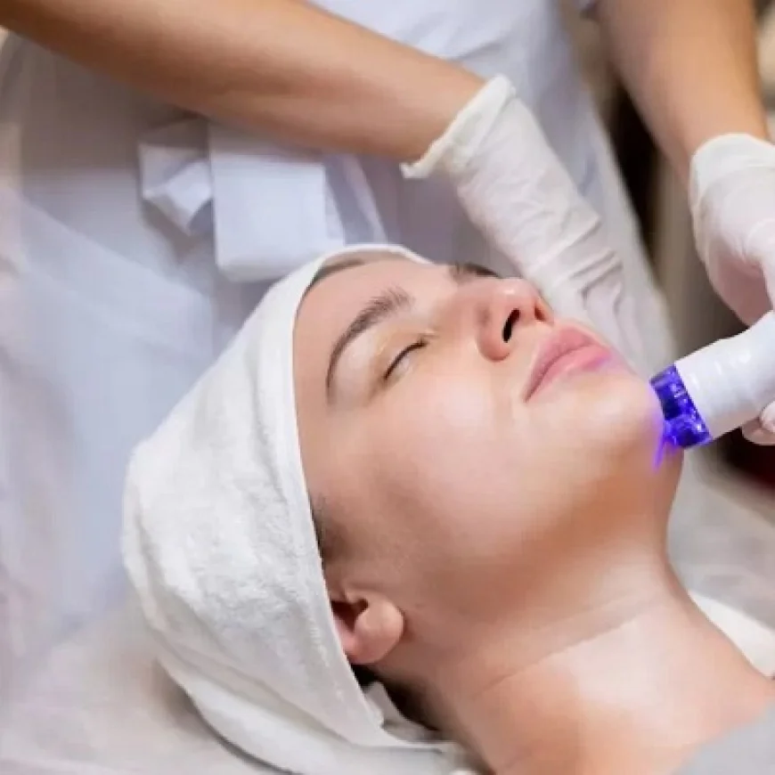 علاج حب الشباب باستخدام أقنعة الوجه