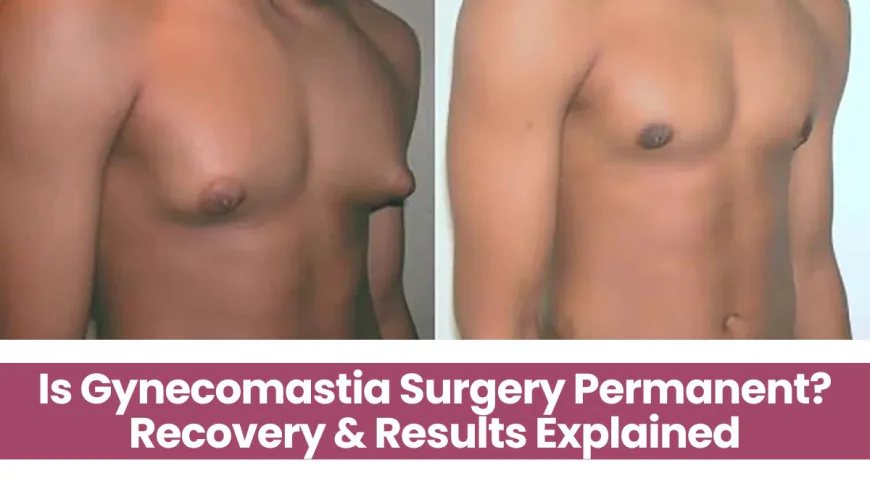 Is Gynecomastia Surgery Permanent? Recovery & Results Explained
