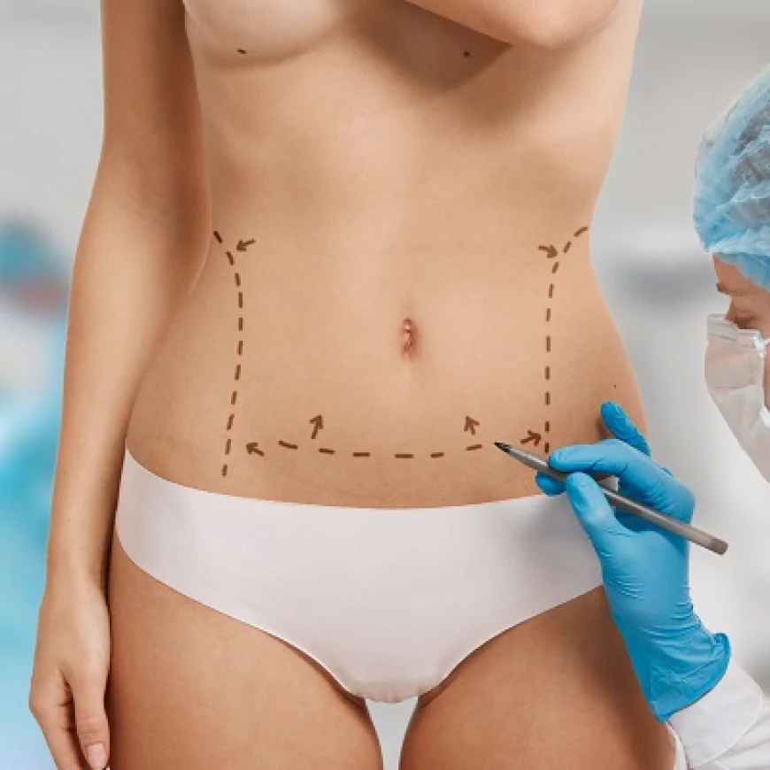 شفط الدهون للحصول على نتائج طبيعية للجسم