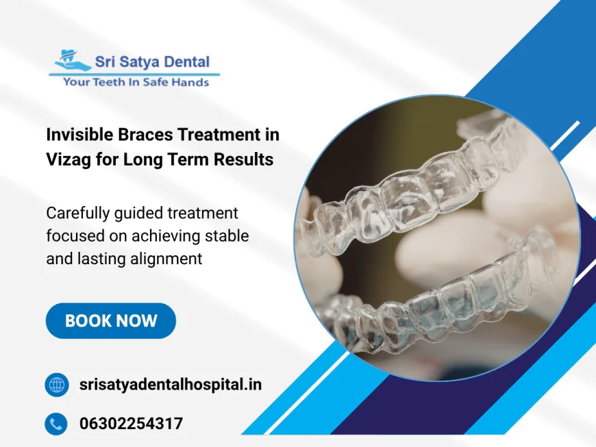 What Factors Affect the Total Duration of Invisible Braces Treatment