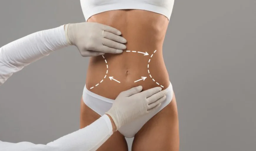 Reclaiming Your Shape: Life After Weight Loss with a Riyadh Body Lift