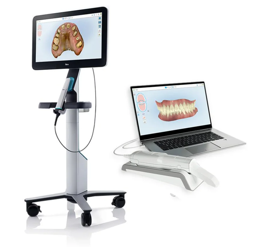 3D Scanner iTero Scan for Faster Dental Solutions