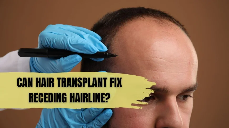 Can Hair Transplant Fix Receding Hairline?