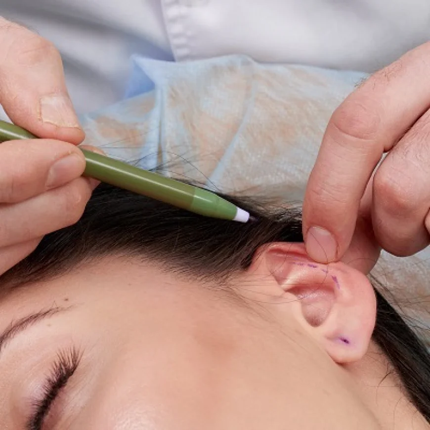 إعادة تشكيل الأذن: ما النتائج التي يمكنك توقعها؟