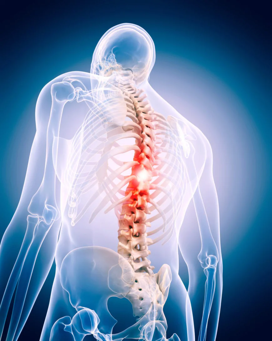 Spine Surgery Success Rate in India: Factors, Outcomes & Expert Care Guide