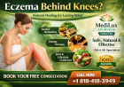 Eczema Behind Knees Treatment in USA & UK | Natural Relief with MediLux Ayurveda
