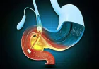 Recurring Upper Abdominal Pain? It Might Be Time to See a Gallbladder Specialist