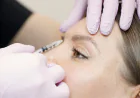 The Non-Surgical Brow Lift: Reopening the Eyes with Botox Precision
