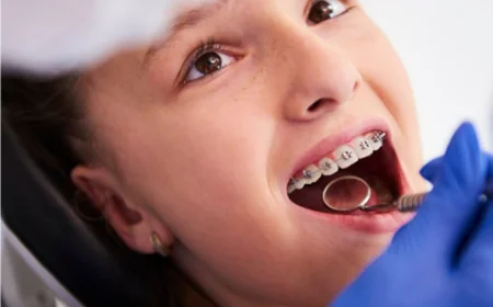 Achieve a Confident Smile with Teeth Straightening Adelaide at Dental Excellence