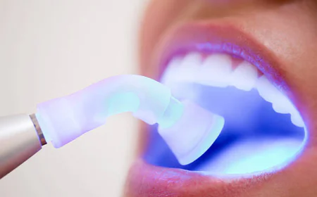 Everything You Need to Know About Dental Fillings for a Healthy Smile